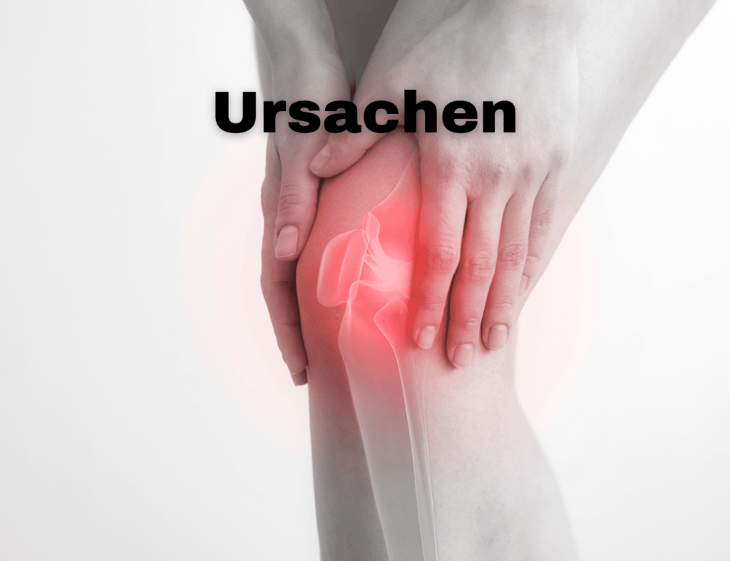 Eine Person, die ein Knie mit einem Knorpelschaden hält